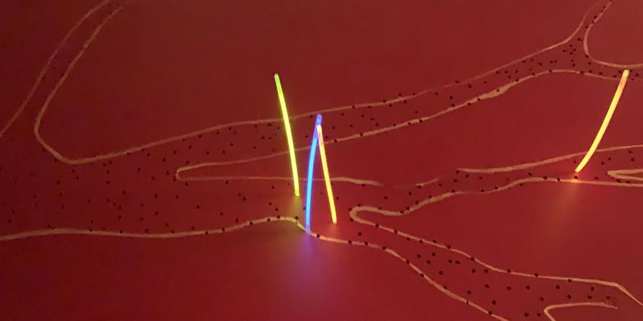 image - 10 ans de MUZE'UM L : Martine Platteau : Light Needling