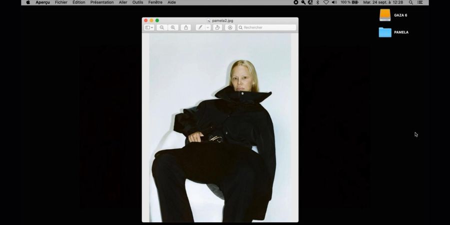 image - How Pamela Anderson and my camera made me look at women who have plastic surgery - Nina Gazaniol Vérité